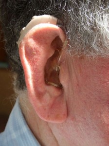 hearing aid costs