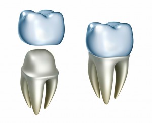 tooth crown cost without insurance